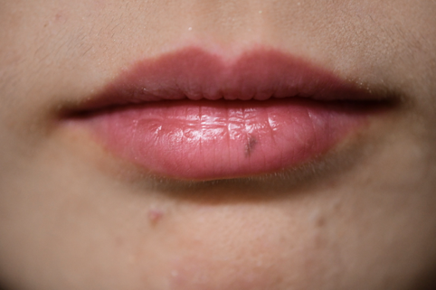 下口唇にほぼ境界明瞭な淡褐色の小さい色素斑が縦に配列しています。