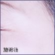 施術後