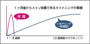 タイトニング効果