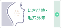 にきび跡・毛穴外来