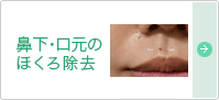 鼻下・口元のほくろ除去