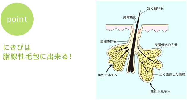 ポイント