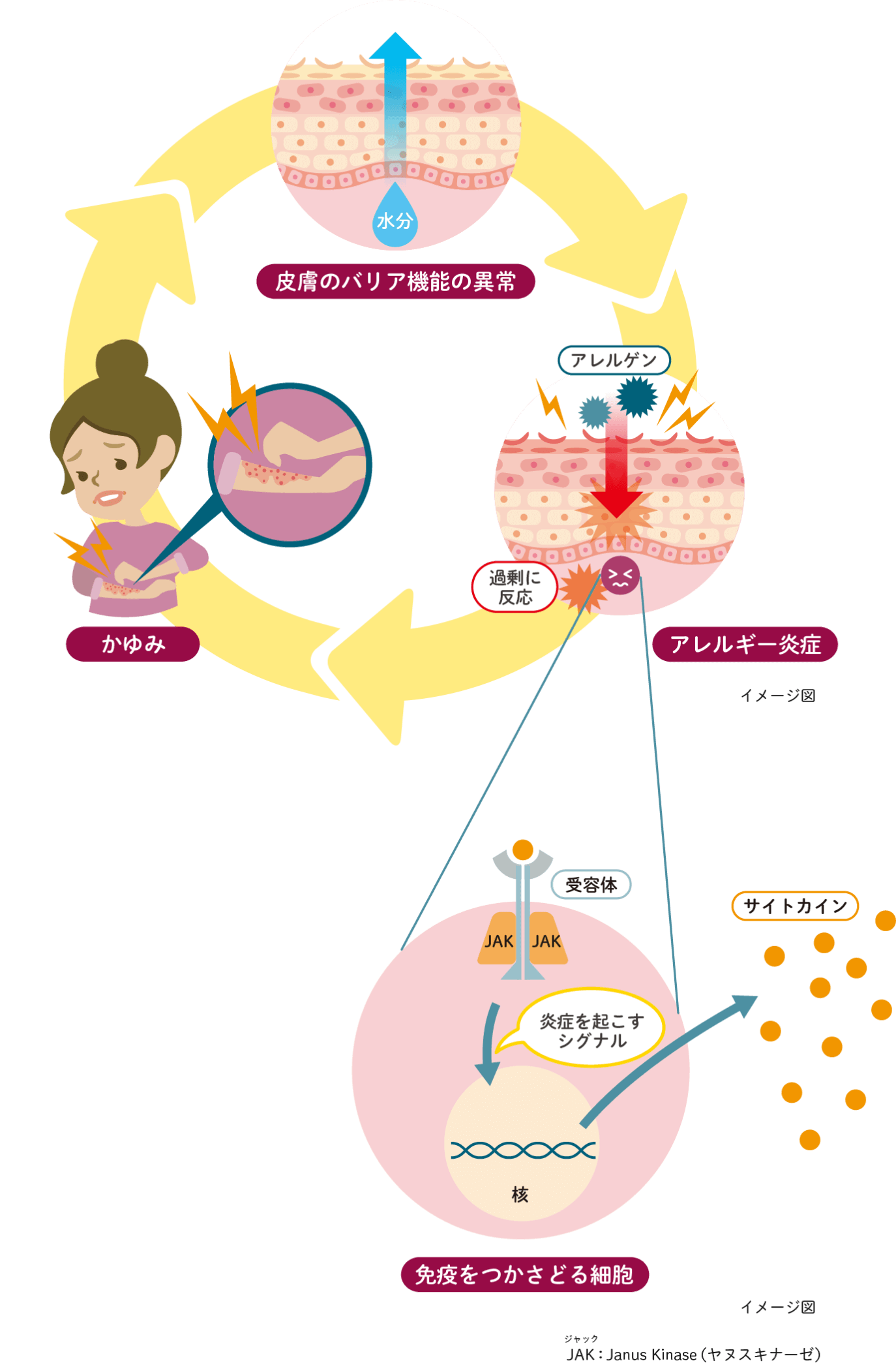 アトピー性皮膚炎とは