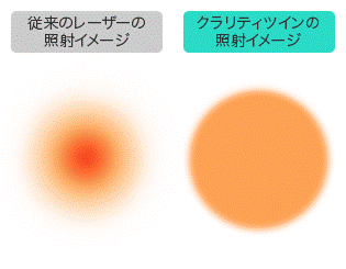 クラリティツインの照射イメージ