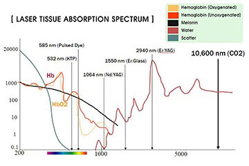 エルビウムヤグレーザーは周辺組織へのダメージが少ない