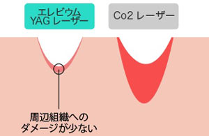 傷跡が早く治り、綺麗に仕上がる